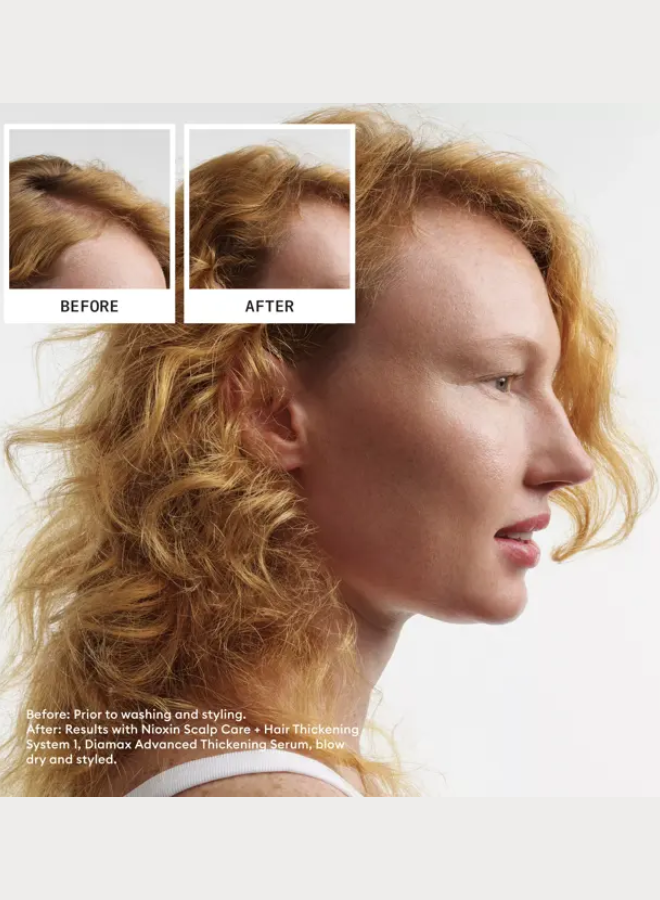 NIOXIN System Kit 1